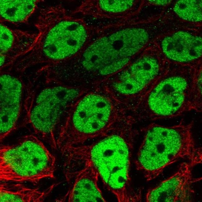 BCL9L Antibody in Immunocytochemistry (ICC/IF)