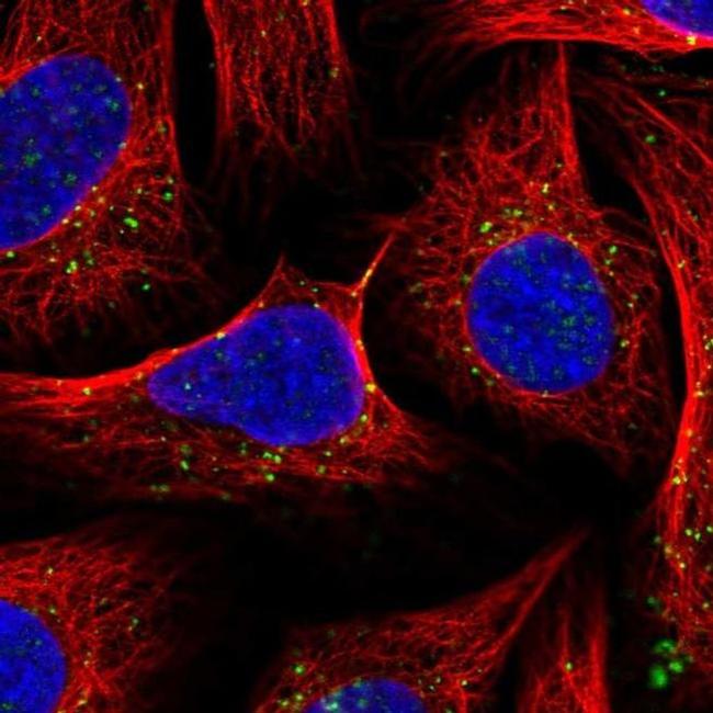 SNX6 Antibody in Immunocytochemistry (ICC/IF)