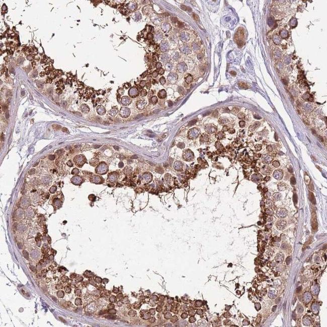 POLR3F Antibody in Immunohistochemistry (IHC)