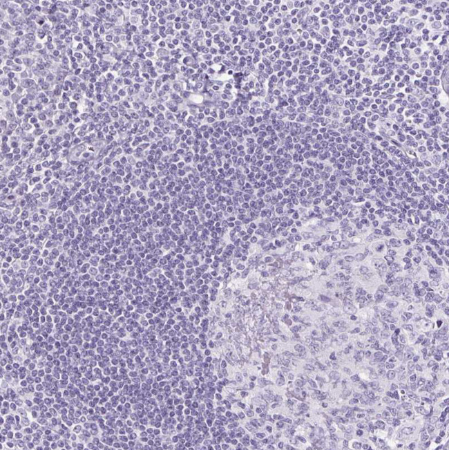 Podocin Antibody in Immunohistochemistry (Paraffin) (IHC (P))