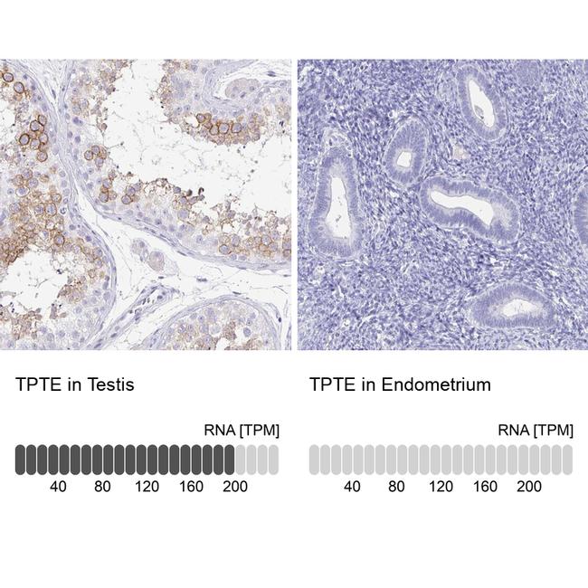 PTEN2 Antibody in Immunohistochemistry (IHC)