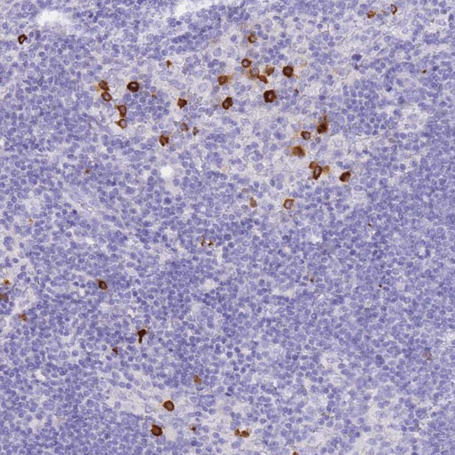 HERC1 Antibody in Immunohistochemistry (Paraffin) (IHC (P))