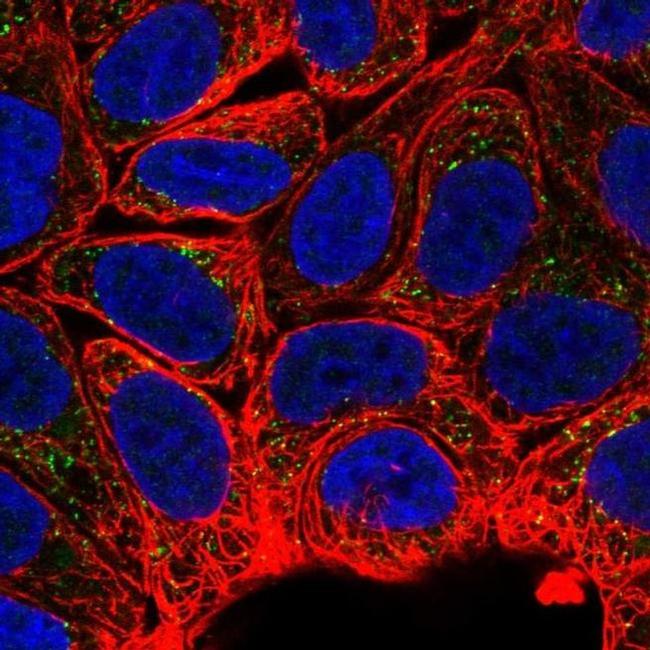 MTMR2 Antibody in Immunocytochemistry (ICC/IF)