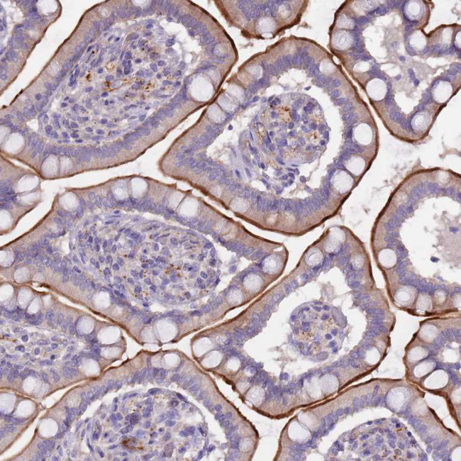 NTN4 Antibody in Immunohistochemistry (Paraffin) (IHC (P))