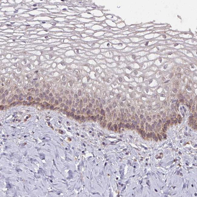 MAGT1 Antibody in Immunohistochemistry (IHC)