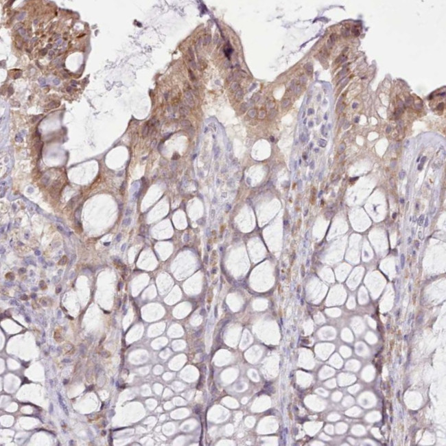 CCL1 Antibody in Immunohistochemistry (Paraffin) (IHC (P))