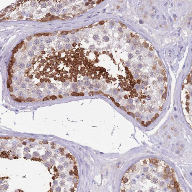 DDHD1 Antibody in Immunohistochemistry (Paraffin) (IHC (P))