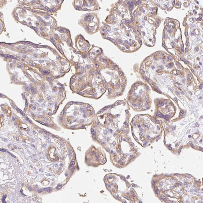 EHD3 Antibody in Immunohistochemistry (Paraffin) (IHC (P))