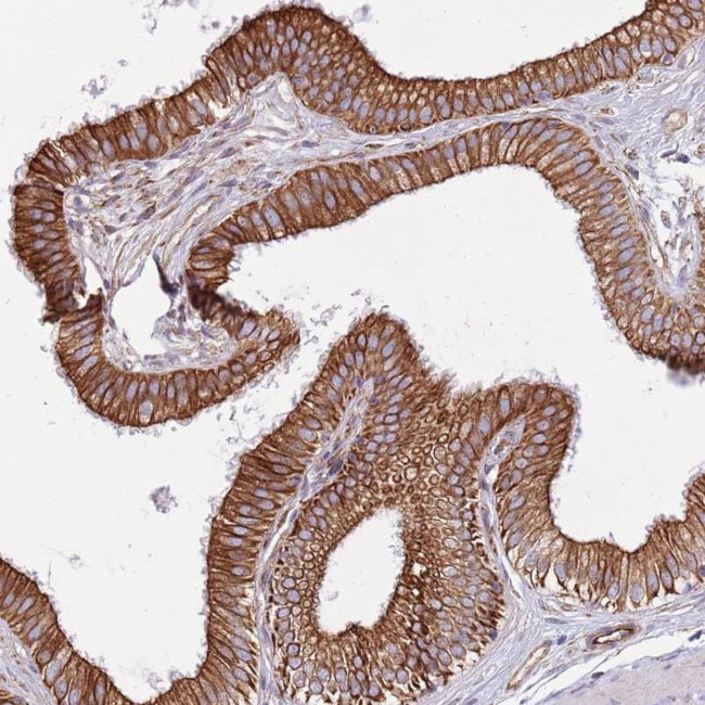 MOGAT1 Antibody in Immunohistochemistry (Paraffin) (IHC (P))