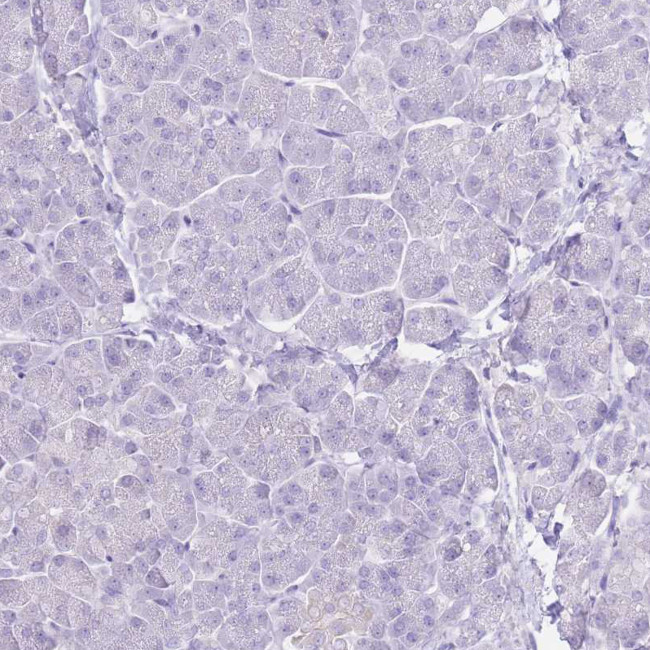 HRG Antibody in Immunohistochemistry (Paraffin) (IHC (P))