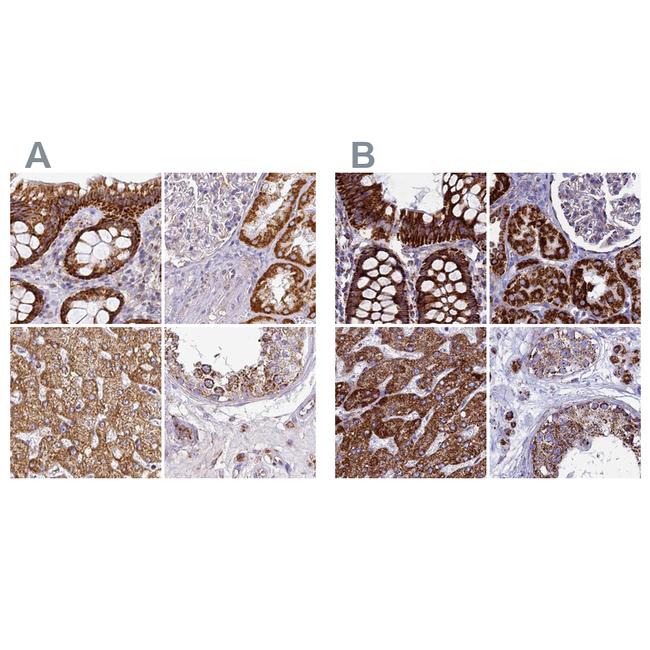 UQCRFS1 Antibody in Immunohistochemistry (IHC)