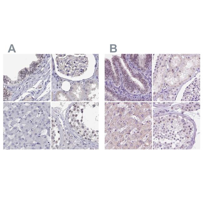 NHP2 Antibody in Immunohistochemistry (IHC)