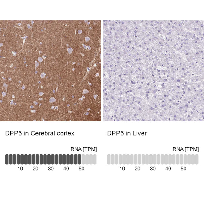 DPP6 Antibody in Immunohistochemistry (Paraffin) (IHC (P))