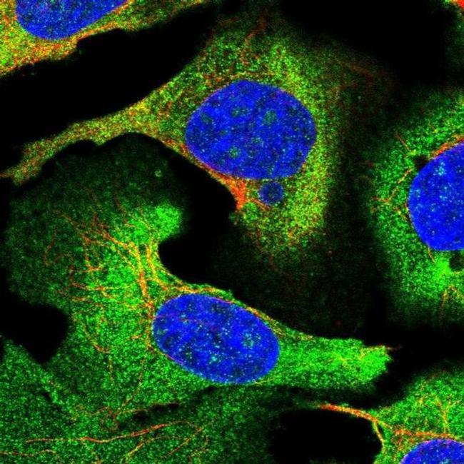 STEAP3 Antibody in Immunocytochemistry (ICC/IF)