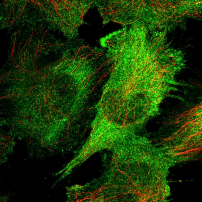 CAP2 Antibody in Immunocytochemistry (ICC/IF)