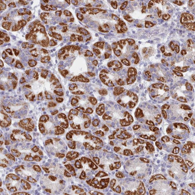 FAM170B Antibody in Immunohistochemistry (Paraffin) (IHC (P))