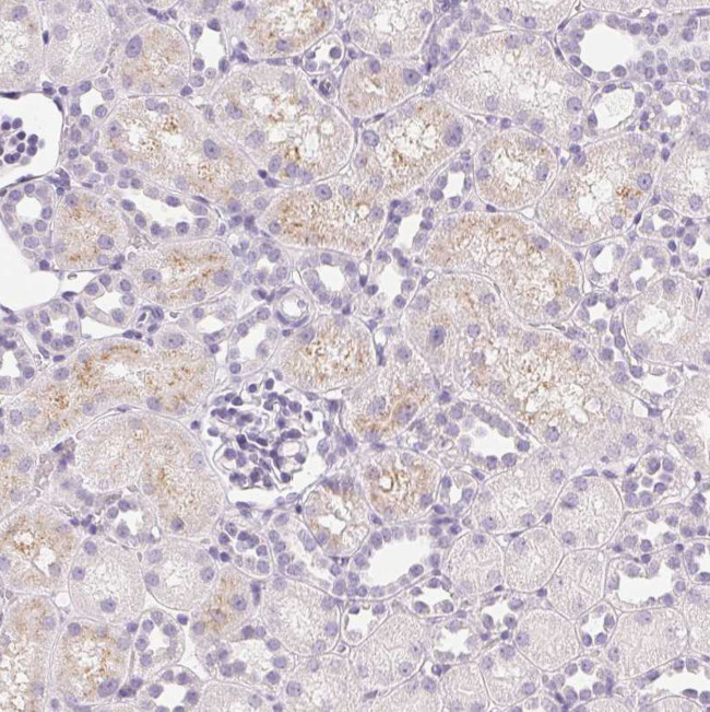 IGFBP-1 Antibody in Immunohistochemistry (Paraffin) (IHC (P))