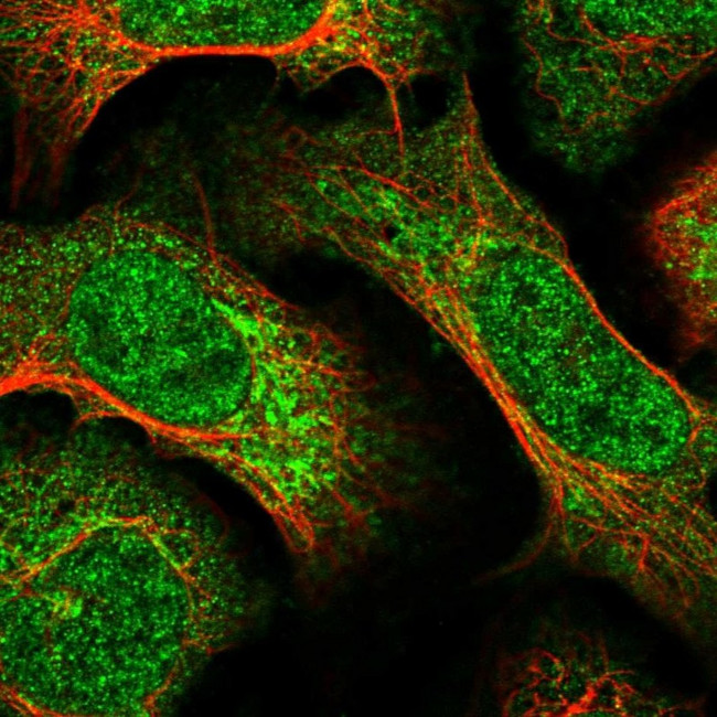 HIVEP1 Antibody in Immunocytochemistry (ICC/IF)