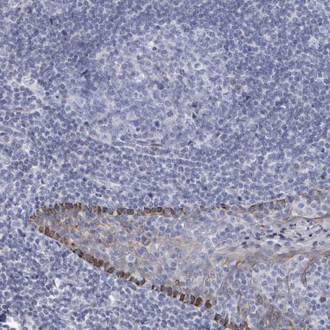 NTN3 Antibody in Immunohistochemistry (Paraffin) (IHC (P))