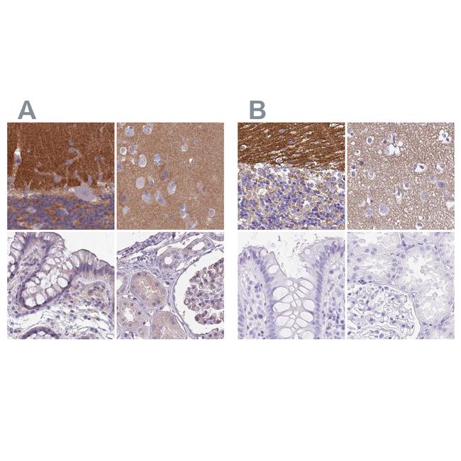 SLC8A2 Antibody in Immunohistochemistry (IHC)