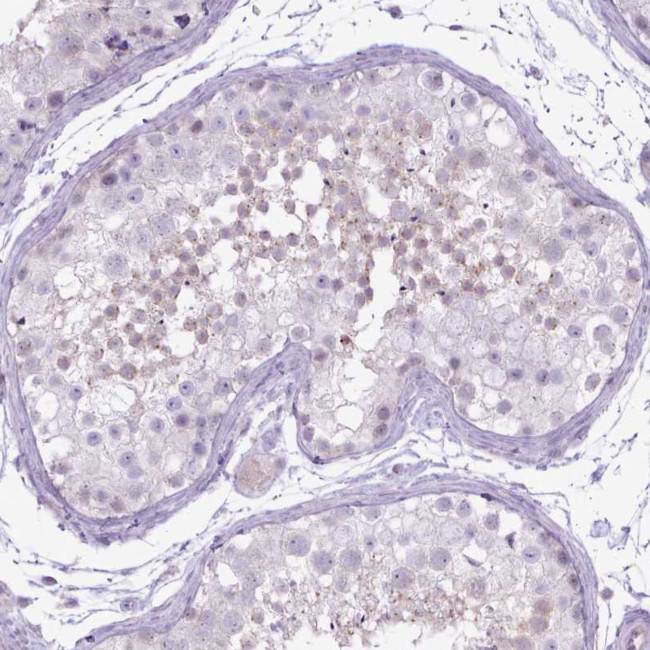 BDKRB2 Antibody in Immunohistochemistry (Paraffin) (IHC (P))