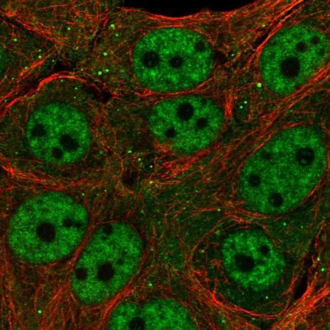 TET3 Antibody in Immunocytochemistry (ICC/IF)