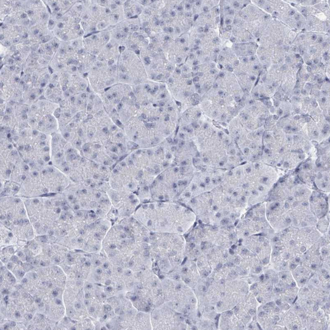 C10orf99 Antibody in Immunohistochemistry (Paraffin) (IHC (P))