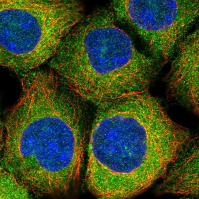 MAP1S Antibody in Immunocytochemistry (ICC/IF)