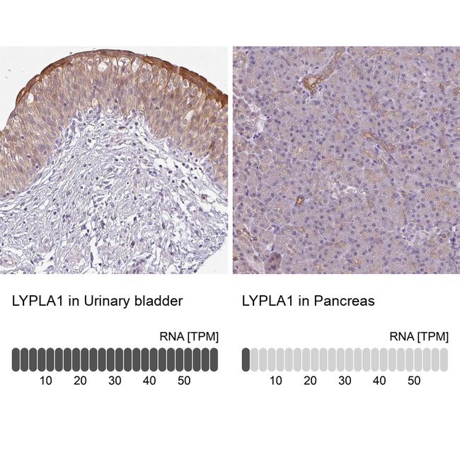 LYPLA1 Antibody in Immunohistochemistry (IHC)