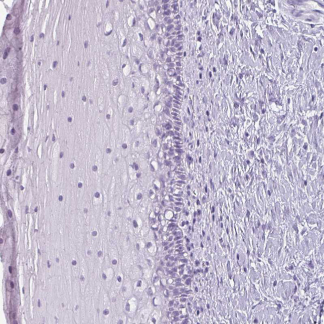 Secretin Antibody in Immunohistochemistry (Paraffin) (IHC (P))