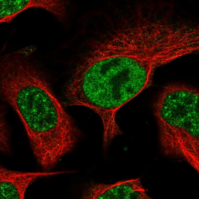 UCK1 Antibody in Immunocytochemistry (ICC/IF)