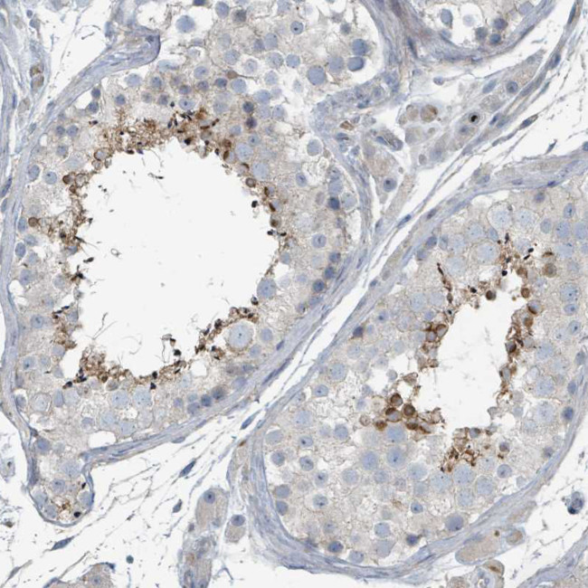 SLC44A5 Antibody in Immunohistochemistry (Paraffin) (IHC (P))