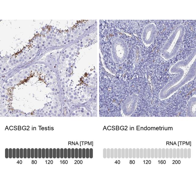 ACSBG2 Antibody in Immunohistochemistry (IHC)