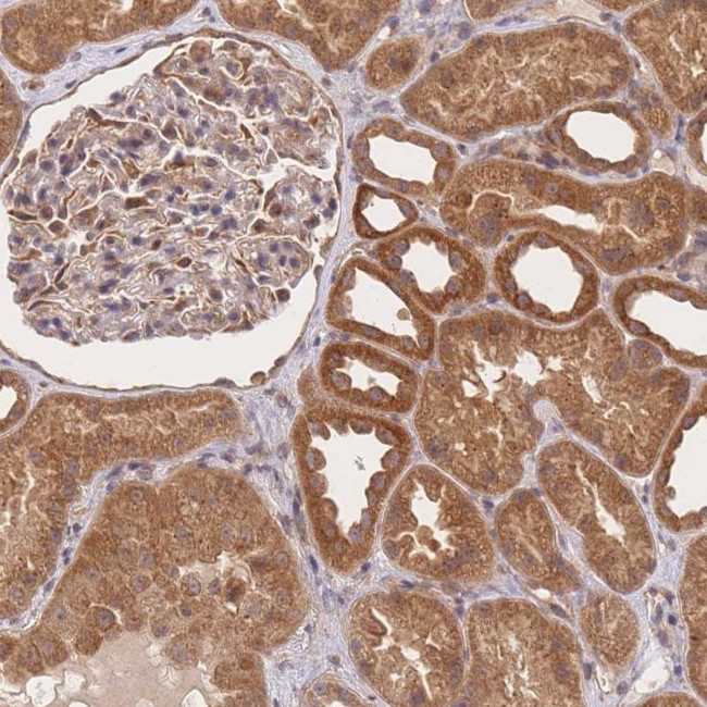 ST8SIA4 Antibody in Immunohistochemistry (Paraffin) (IHC (P))