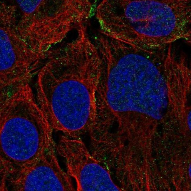 KANK3 Antibody in Immunocytochemistry (ICC/IF)