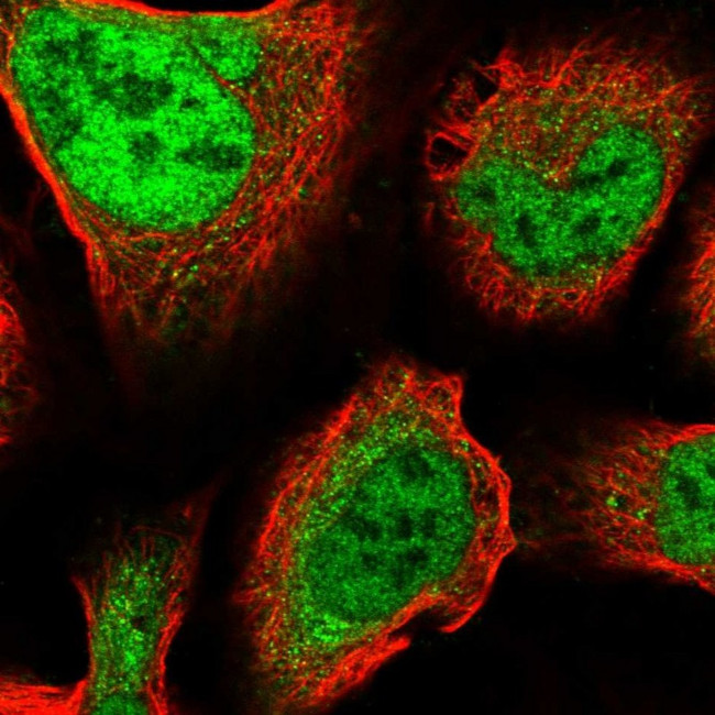 ZNF281 Antibody in Immunocytochemistry (ICC/IF)