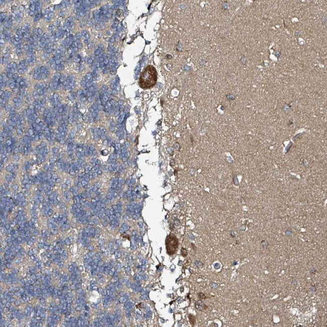 B3GAT3 Antibody in Immunohistochemistry (Paraffin) (IHC (P))