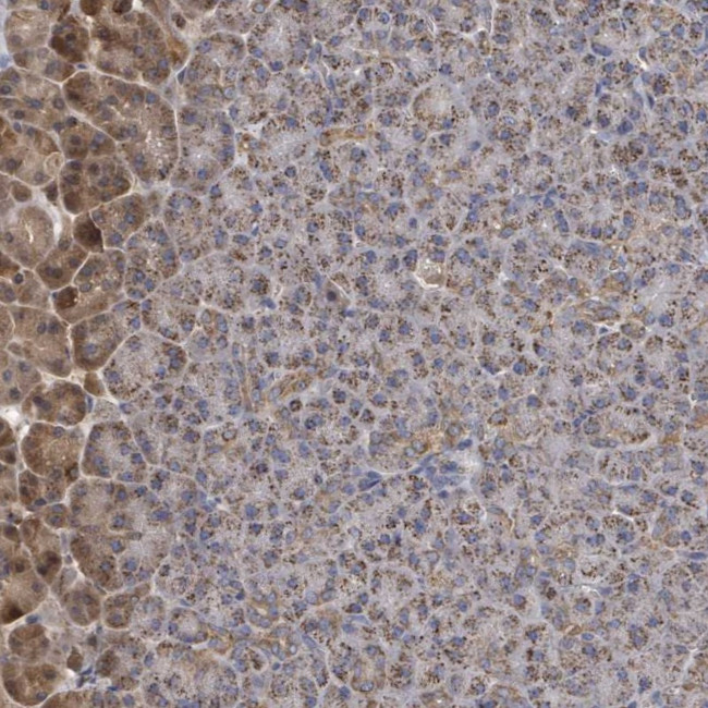 MTMR12 Antibody in Immunohistochemistry (Paraffin) (IHC (P))