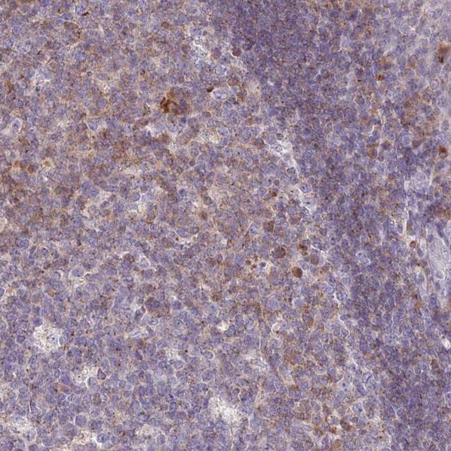 Ly-108 Antibody in Immunohistochemistry (IHC)