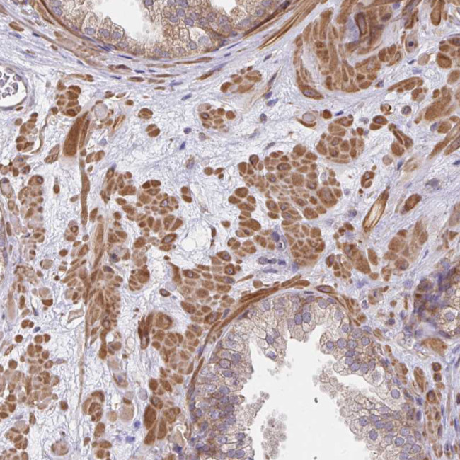 LARP1 Antibody in Immunohistochemistry (Paraffin) (IHC (P))