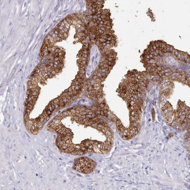 SRD5A1 Antibody in Immunohistochemistry (Paraffin) (IHC (P))