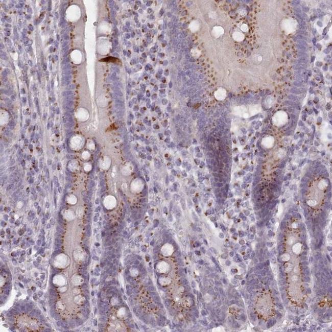 MAN1B1 Antibody in Immunohistochemistry (IHC)