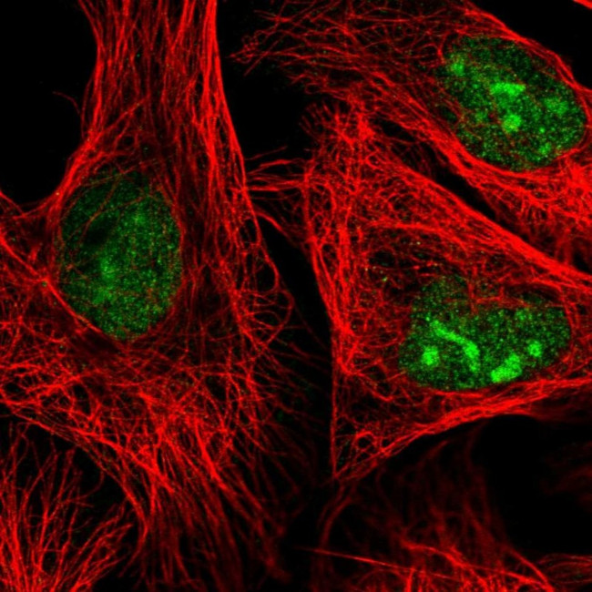 ADAR Antibody in Immunocytochemistry (ICC/IF)