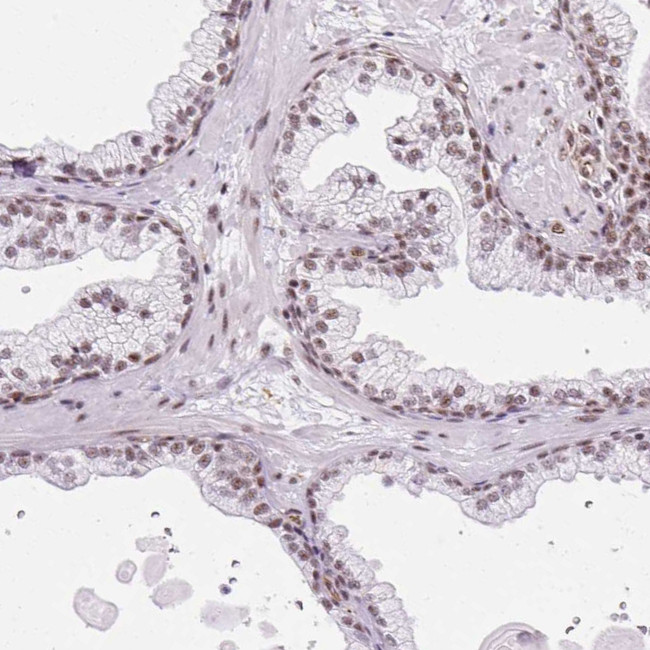 LUC7L2 Antibody in Immunohistochemistry (Paraffin) (IHC (P))