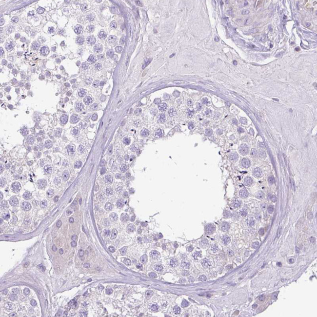 HOXC13 Antibody in Immunohistochemistry (Paraffin) (IHC (P))