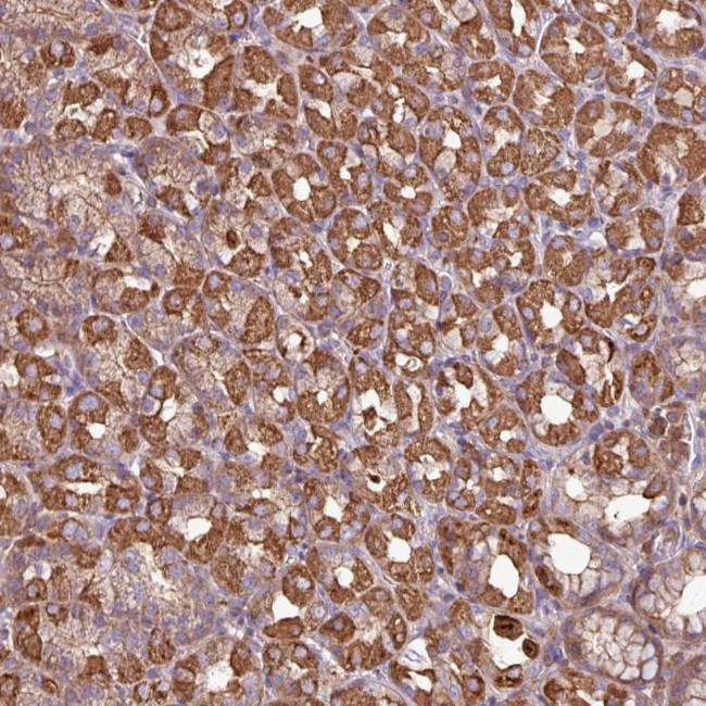 Arp3 Antibody in Immunohistochemistry (Paraffin) (IHC (P))