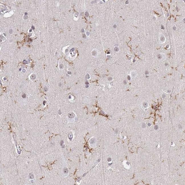 TMEM119 Antibody in Immunohistochemistry (IHC)