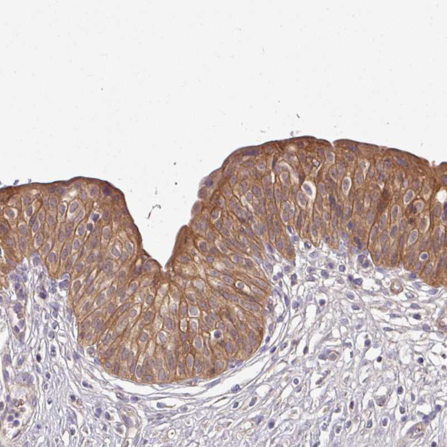 Ly-108 Antibody in Immunohistochemistry (Paraffin) (IHC (P))