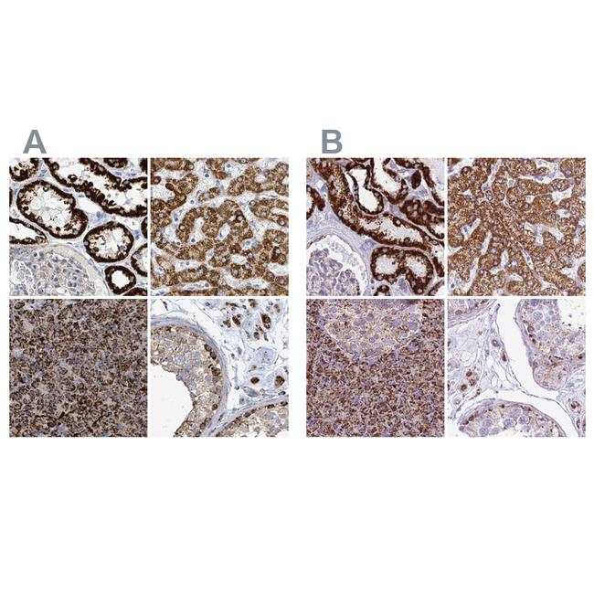 SUCLG2 Antibody in Immunohistochemistry (IHC)