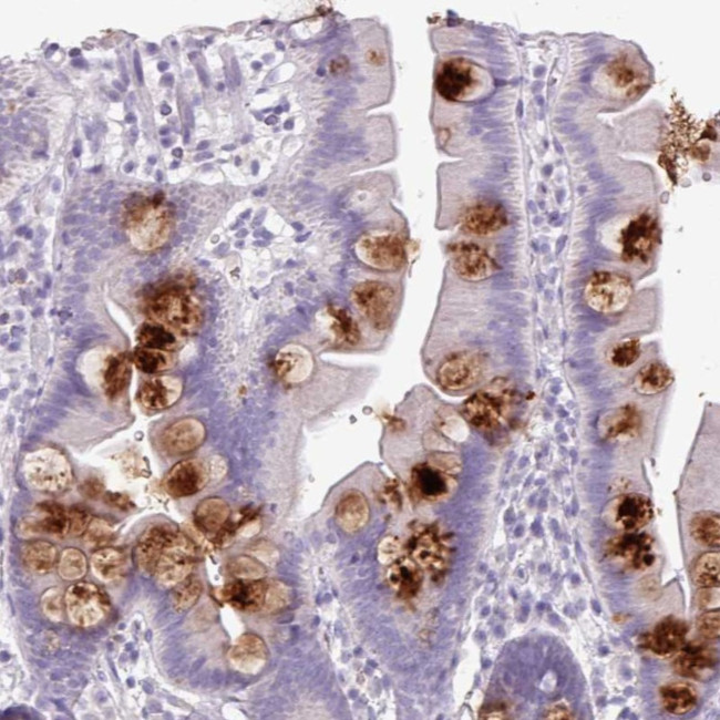 OR2T10 Antibody in Immunohistochemistry (Paraffin) (IHC (P))